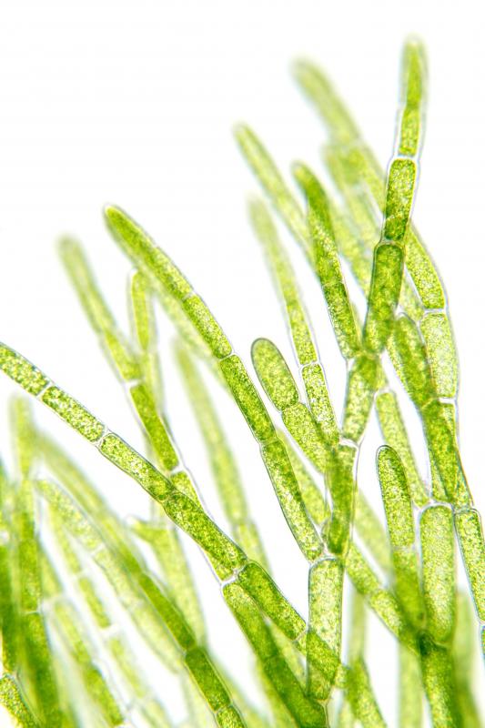 Algae as seen through a microscope.