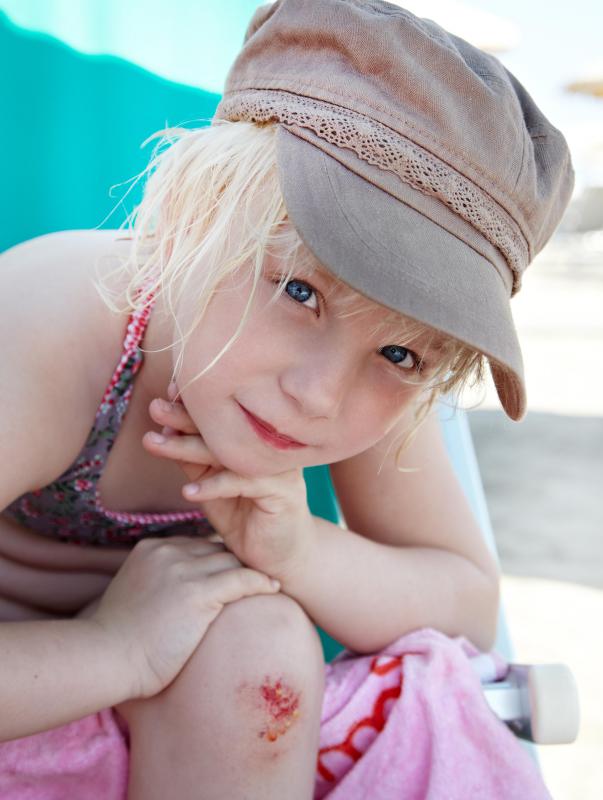 Turf grass can be a safer alternative to gravel or paved areas at a playground.