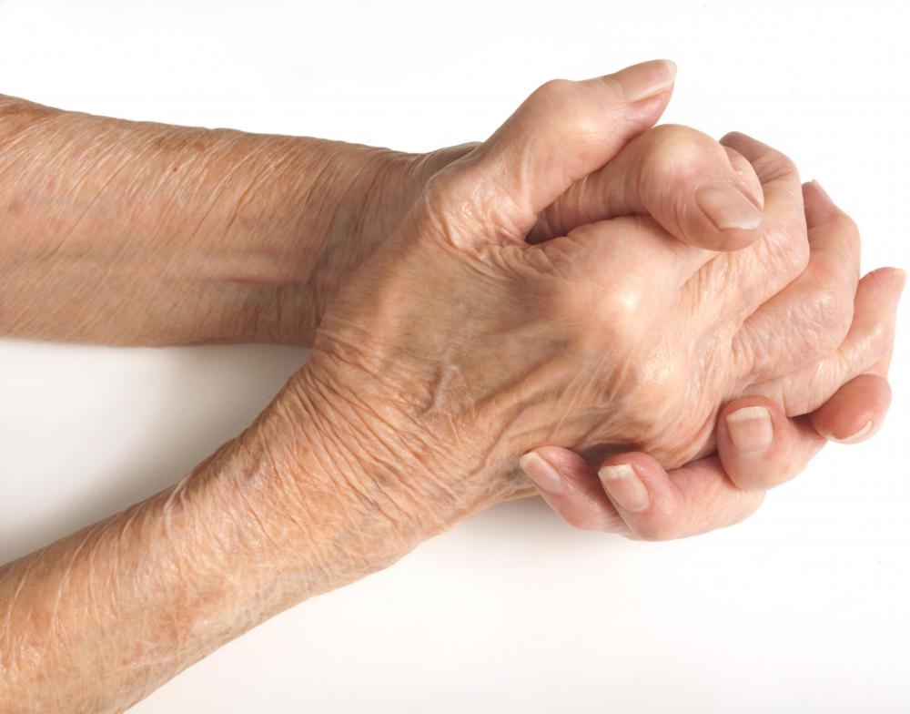 Yucca has been used to treat arthritis.