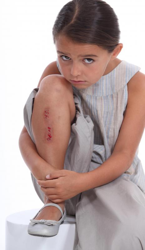 Soaking in a hot bath may be beneficial in the treatment of minor injuries.