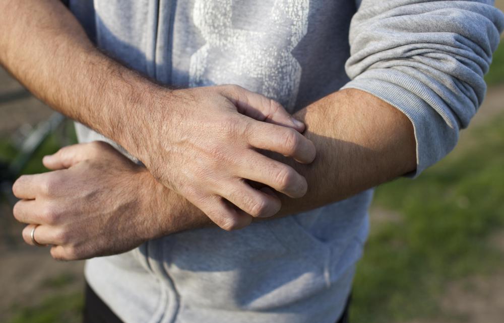 Poison ivy can cause severe itching.