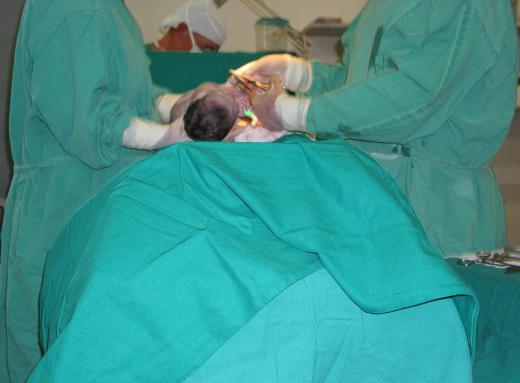 Co-sleepers may be a big help for new mothers who are recovering from a c-section.